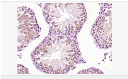 6052bcd8dc445.png image.png