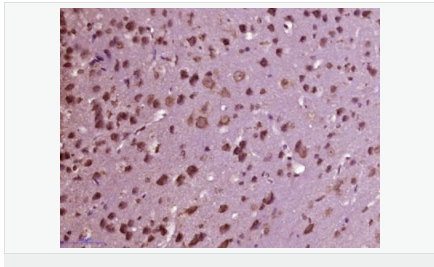 6052c0a83150b.png image.png