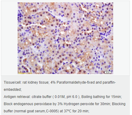 60583926d5a25.png image.png