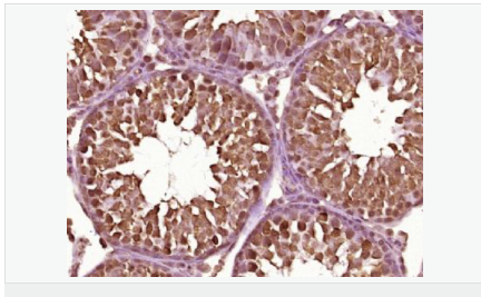 605958c23ed03.png image.png