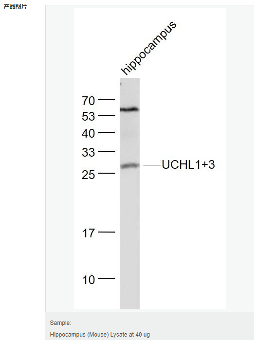 605961156a130.png image.png