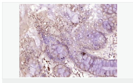 605d932ca6d9b.png image.png