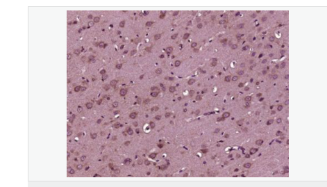 605da104608bf.png image.png