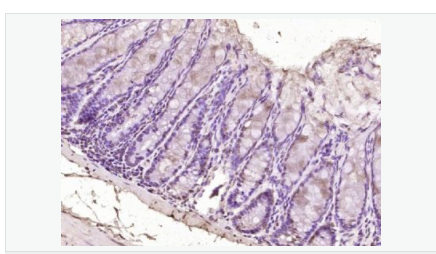 6063cf4d10b85.png image.png