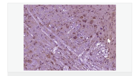 606415a2585ce.png image.png