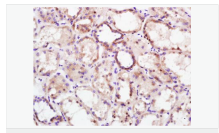 6065322f1906d.png image.png