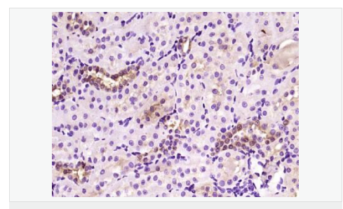 6066bd60ed60c.png image.png