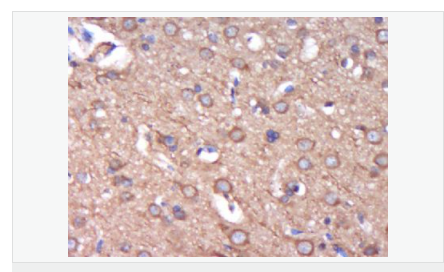 606bcff31df1a.png image.png