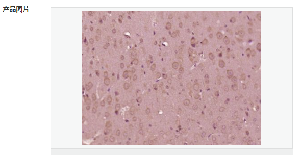 6076a7596ec1c.png image.png